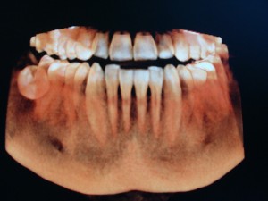 cbct 6x8 jeden luk.